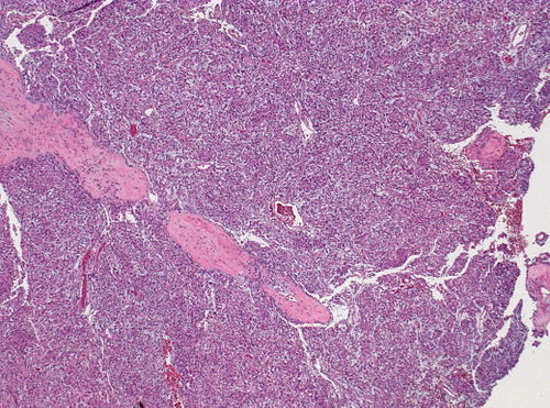 Neuropathology case XI 01.jpg