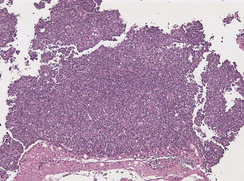 Neuropathology case IV 01.jpg