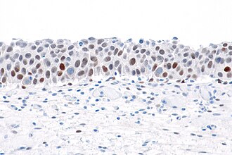 p53 IHC
