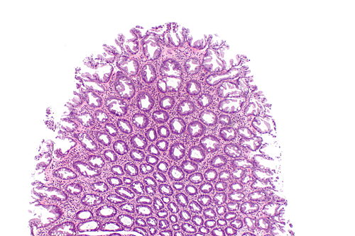 Hyperplastic polyp -- low mag.jpg