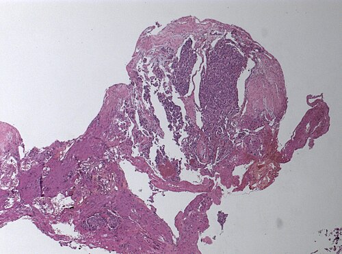 Neuropathology case III - 01.jpg