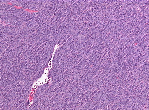 Neuropathology case VII 03.jpg