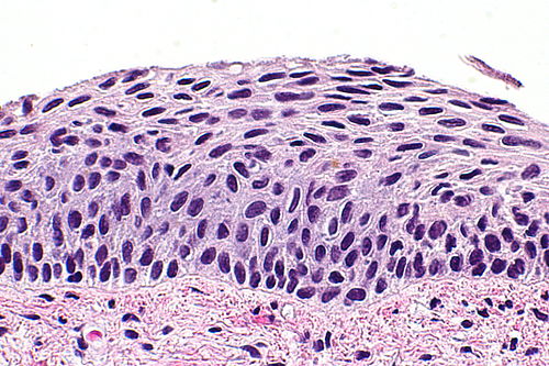 Atrophic cervix - 2 -- very high mag.jpg