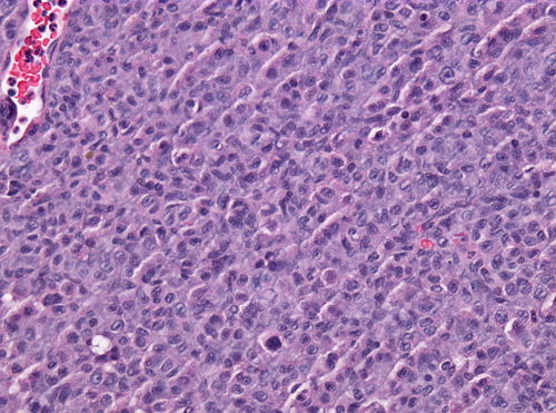 Neuropathology case VII 02.jpg