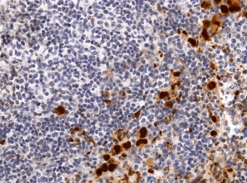 Neuropathology case VIII 05.jpg