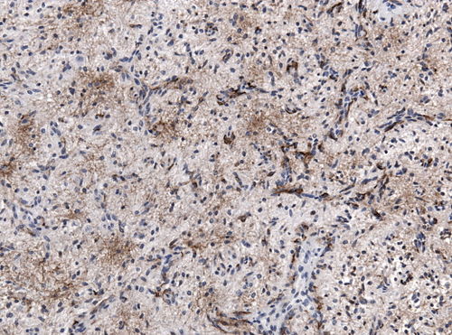 Neuropathology case V 05.jpg