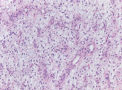 Neuropathology case V 02.jpg