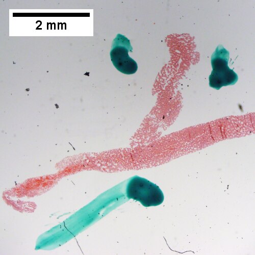 Hemorrhage at left end, dilated sinusoids elsewhere (20X).