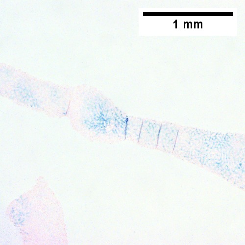 Iron stain shows dense iron deposition (40X).