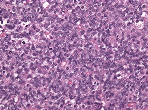 Neuropathology case IV 02.jpg