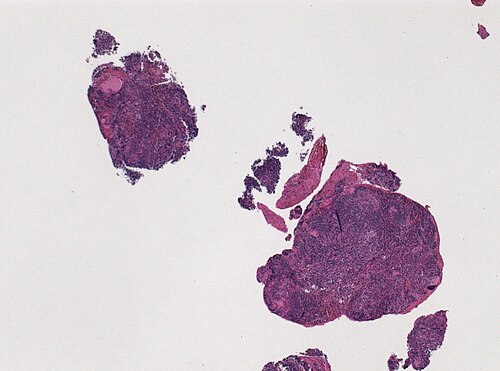 Neuropathology case VIII 01.jpg