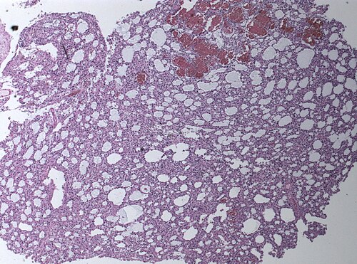 Neuropathology case II 01.jpg