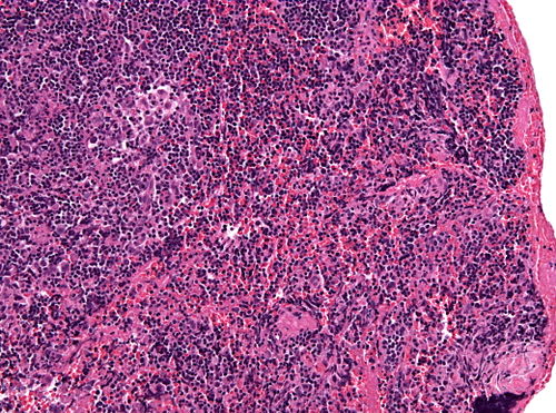 Neuropathology case VIII 02.jpg