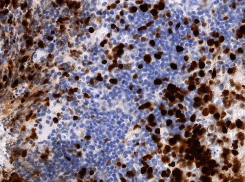 Neuropathology case VIII 04.jpg