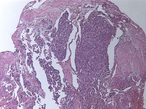 Neuropathology case III - 02.jpg