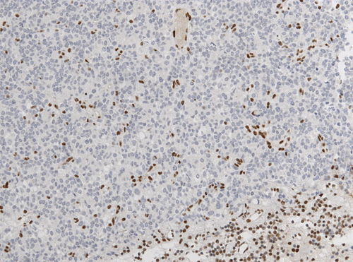 Neuropathology case IV 04.jpg